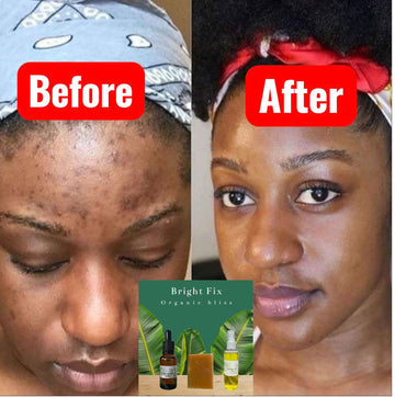Transform Your Well-being Naturally and Effortlessly
