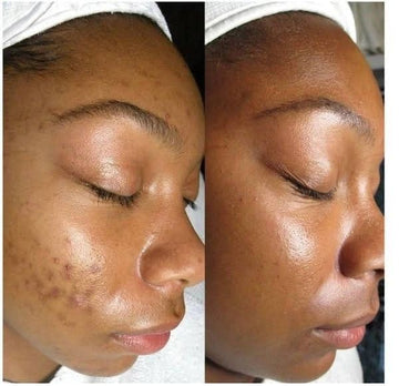 Transform Your Skin Naturally and Effortlessly