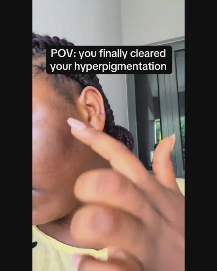 Pigmentation, Dark Marks and Uneven Skin Rivaval